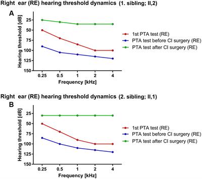 Discovering the Unexpected with the Utilization of NGS in Diagnostics of Non-syndromic Hearing Loss Disorders: The Family Case of ILDR1-Dependent Hearing Loss Disorder